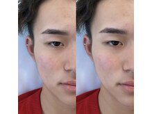 リアアイズ(Li'a eyes)/《メンズ》眉毛ワックス