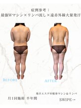 レセラ 銀座店(LE;SERA)/W痩身マシン×リンパ流し＆発汗