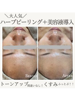 ルシアル(Rucial)/くすみふっとびます！