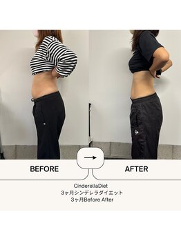 オーシャン整骨院(OCEAN整骨院)/6ヶ月コース