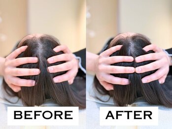 ビハリスト 池袋東口/頭のサイズからしっかり小顔に♪