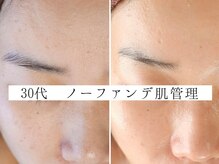 ユウビジン(YOU美人)/