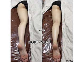 ノリスズ(NORI SUZU)/浮腫みにくい真っ直ぐな脚に矯正