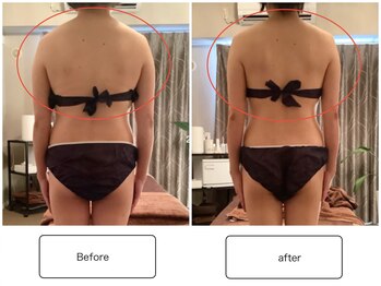 スラン(Slan)/ブライダルエステ