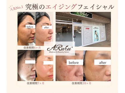 アルルプラス 南草津(ARuru+)の写真