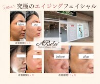 アルルプラス 南草津(ARuru+)