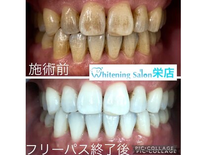 ホワイトニングサロン 名古屋 栄店の写真