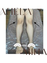 アーネラミーナ(Anela mina)/骨盤、矯正骨の調整の施術例です