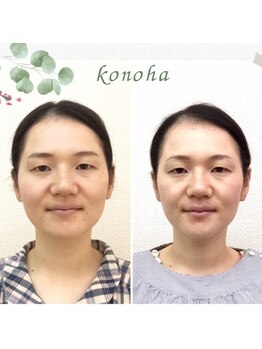 木の葉/30代/むくみ,輪郭,お顔を小さく