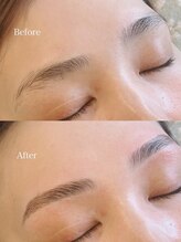 クオルーチェ(CuoLuce)/お悩み：眉頭の癖改善