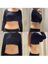 エン ボディアンドフェイシャル(En)/腸セラピー/腸もみ　５回