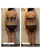 ナル(NALU)/オールハンドボディ