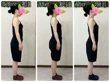 美容整体 綾/横から見る美姿勢とは！
