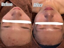 ティエット(tiet)