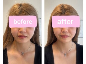 ツナギ 新座(TSUNAGI)/BeforeAfter