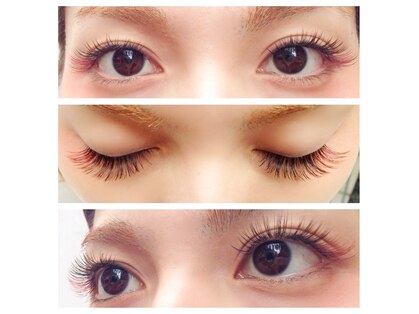 エターナルラッシュ(ETERNAL rush)の写真