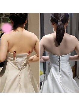 サニー(SUNNY)/閉まらなかったボタンも…♪