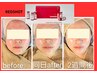 人気のためさらにお得に！【脂肪ケア☆REDSHOT】回数券のご相談はこちらから