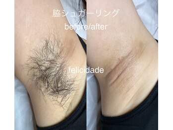 フェリシダージ(felicidade)/脇シュガーリング