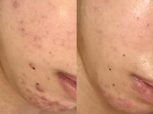 アン(An)の雰囲気(お肌悩み改善とともに、肌質も滑らかな艶肌に♪)