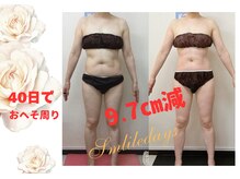 スマイルデイズ(Smiledays)の雰囲気（この夏のボディに自信をつけるチャンス！痩身機が断然効果あり！）