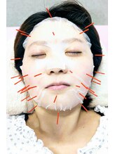 ひかる鍼灸整骨院/幹細胞美容鍼