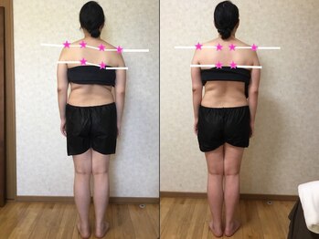 トリコ 鷲塚本店(TORIKO)/肩の高さが整いました♪