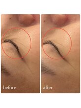 ムク(Muk.)/シワ・シミ・乾燥改善ピーリング