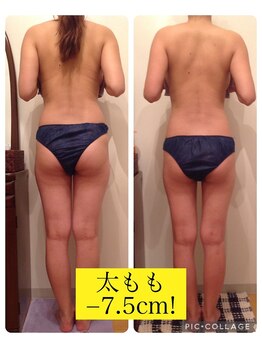 リブラザバランス(LIBRA the balance)/ブライダル前にも