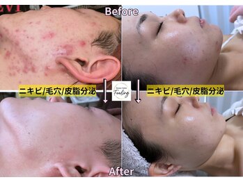 フィーリング(Feeling)