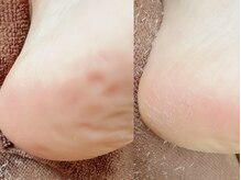 メイハッピー(MEI happy)