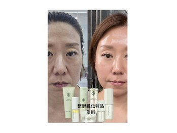 デピラード(Depilado)/インセルダムフェイシャル