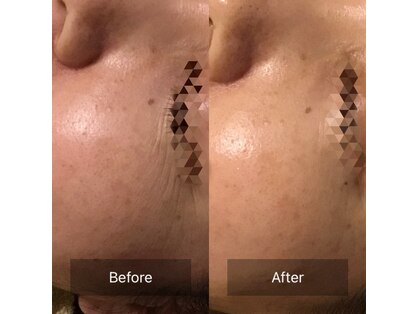 ファヴォリ(favori)の写真