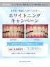 【初心者の方おすすめ】歯を白くセルフホワイトニング初回30分　都度￥8800→