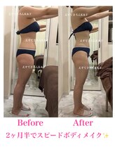 えすてさろん ケイアンドエフ(k&f)/施術結果12回/20代お客様2ヶ月半