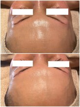 ディオーネ 春日井勝川店(Dione)/マーメイド☆ビフォーアフター