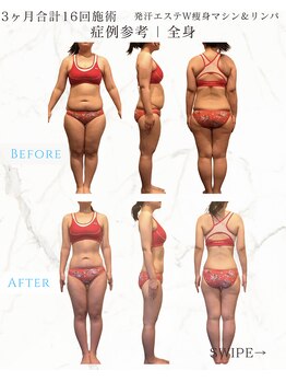 レセラ 銀座店(LE;SERA)/W痩身マシン×リンパ流し＆発汗