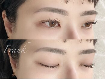 フランク(Frank)