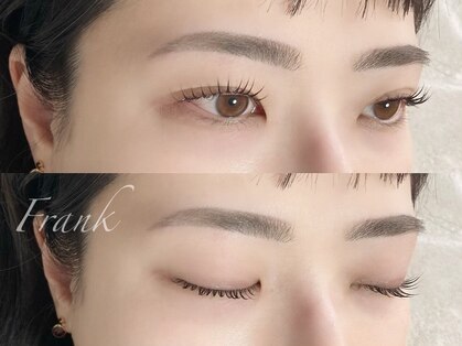 フランク(Frank)の写真
