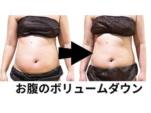 ニュートラル 池袋店(NEUTRAL)/施術結果【痩身/むくみ/痩せる】