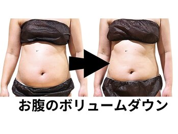 ニュートラル 池袋店(NEUTRAL)/施術結果【痩身/むくみ/痩せる】
