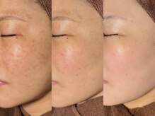 ルーナジェーナ(Luna llena)/池袋　エステ　ルーナジェーナ