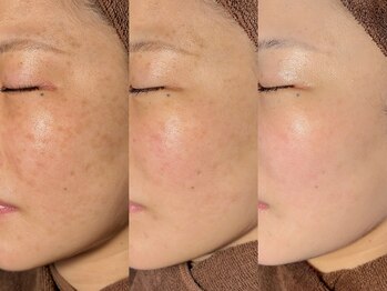 ルーナジェーナ(Luna llena)/池袋　エステ　ルーナジェーナ