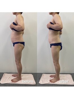 リラクラージュ(Ri Ra Courage)/ 50代2ヶ月後