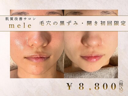 メレ(mele)の写真