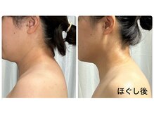 ビジュープラス 幸手店(Bijou+)の雰囲気（深部にアプローチし巡りケア！首肩・背中上部　　　肩こり◎）