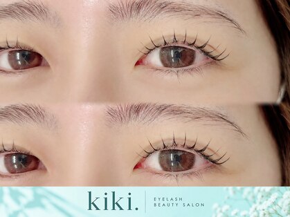 キキ(kiki)の写真