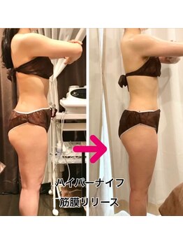 アンリアン 銀座店(Une Lien)/◆結果写真◆