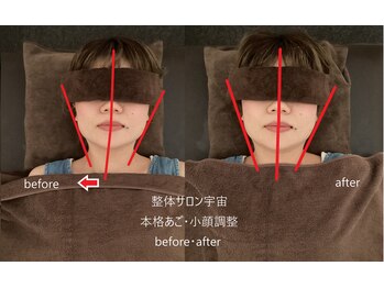 整体サロン宇宙/☆本格あご・小顔矯正☆