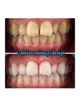 ホワイトニングショップ 所沢店/ホワイトニングショップ所沢店